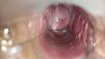 a close-up of an orgasm occurring inside the vagina
