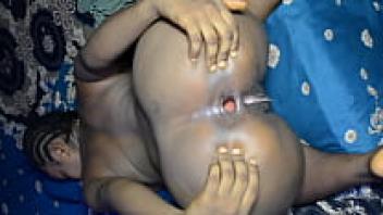 After closure, the gaping ass was loved.